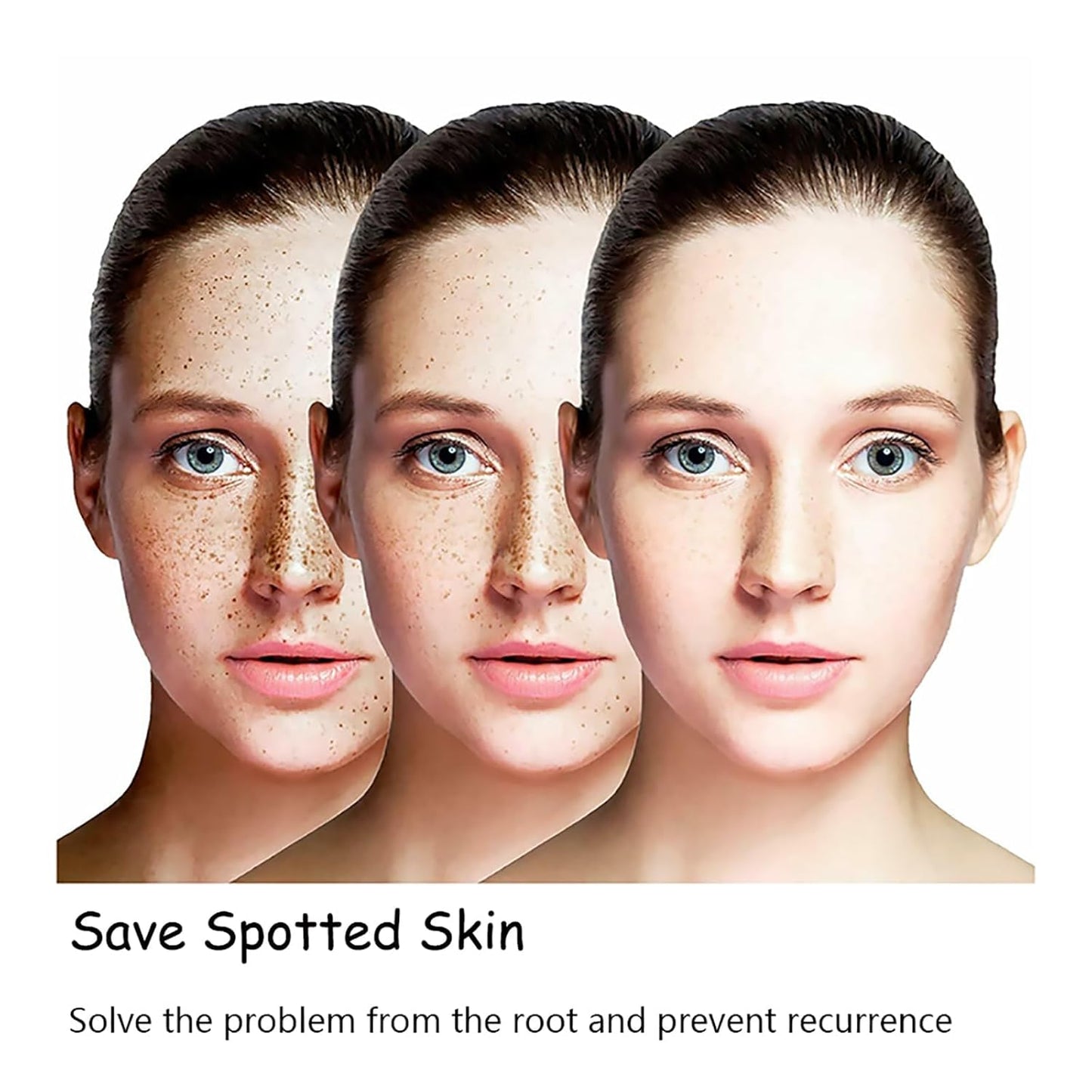 LAST DAY OF DISCOUNT 🔥 ANTI SPOT SERUM