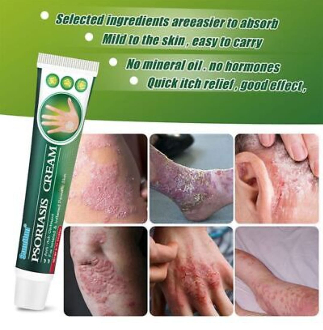 Summifun Psoriasis Cream