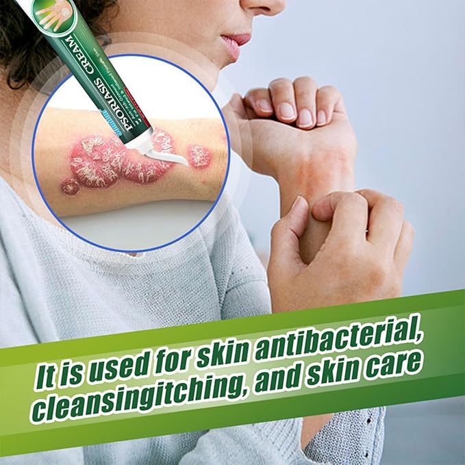 Summifun Psoriasis Cream
