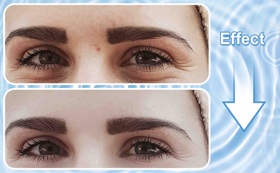 LAST DAY OF DISCOUNT 🔥 ANTI SPOT SERUM