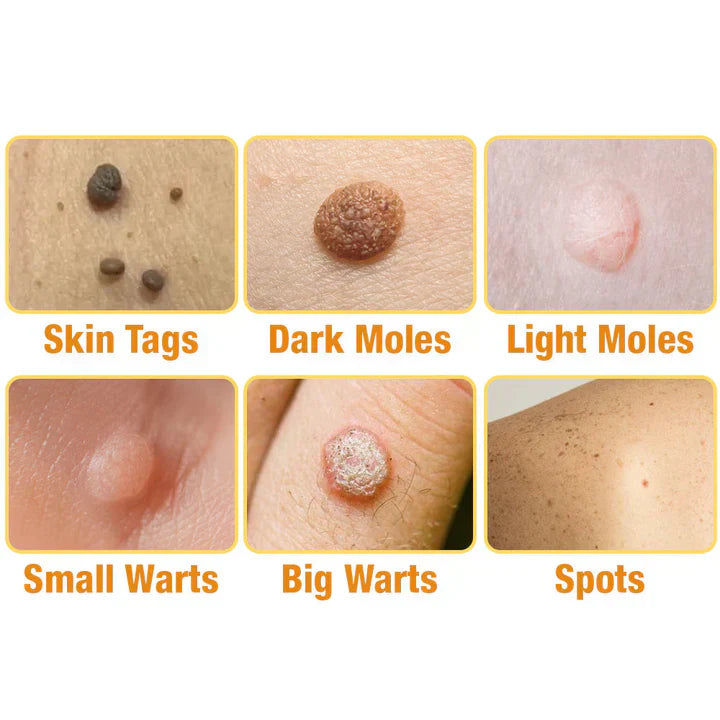 Last Day Of Discount 🔥 TagRecede Bee Venom Treatment Spray