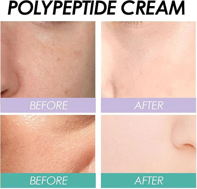 Last Day Of Discount 🔥 Polypeptide Firming Cream