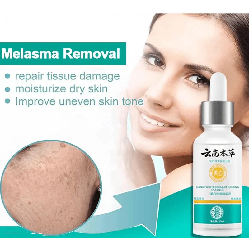 LAST DAY OF DISCOUNT 🔥 ANTI SPOT SERUM