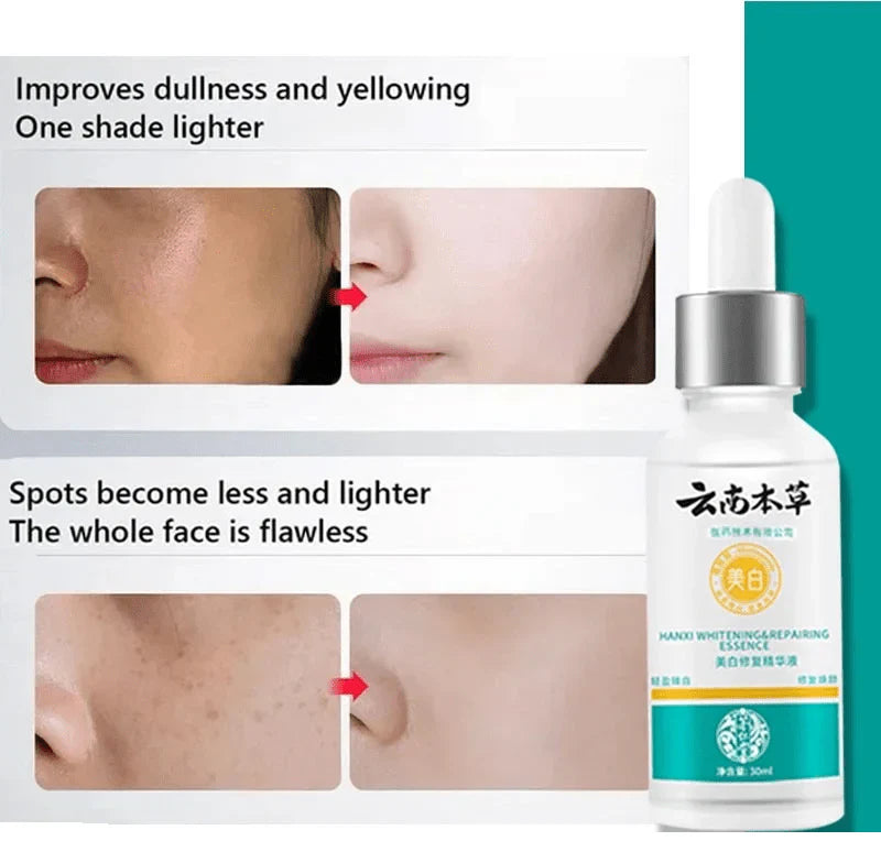 LAST DAY OF DISCOUNT 🔥 ANTI SPOT SERUM