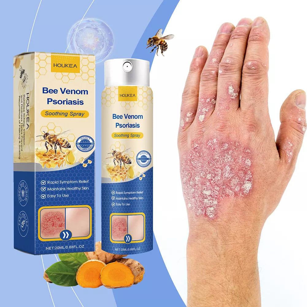 Houkea Bee Venom Psoriasis Soothing Spray