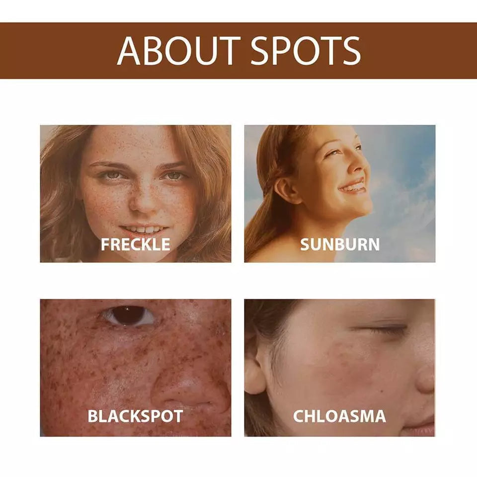 LAST DAY OF DISCOUNT 🔥 ANTI SPOT SERUM