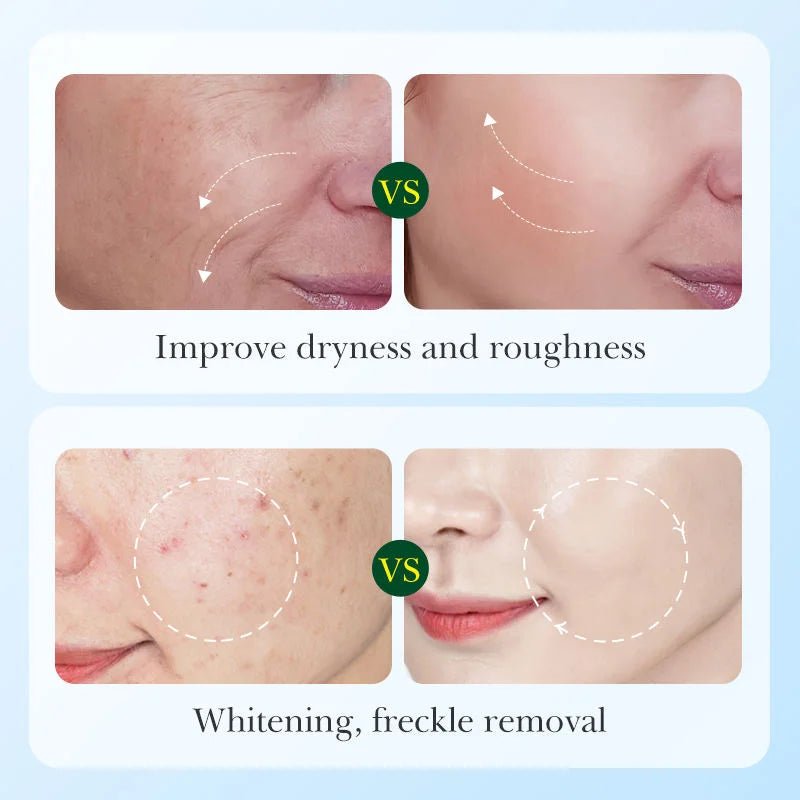 Licorice Root Whitening Skin Care Set