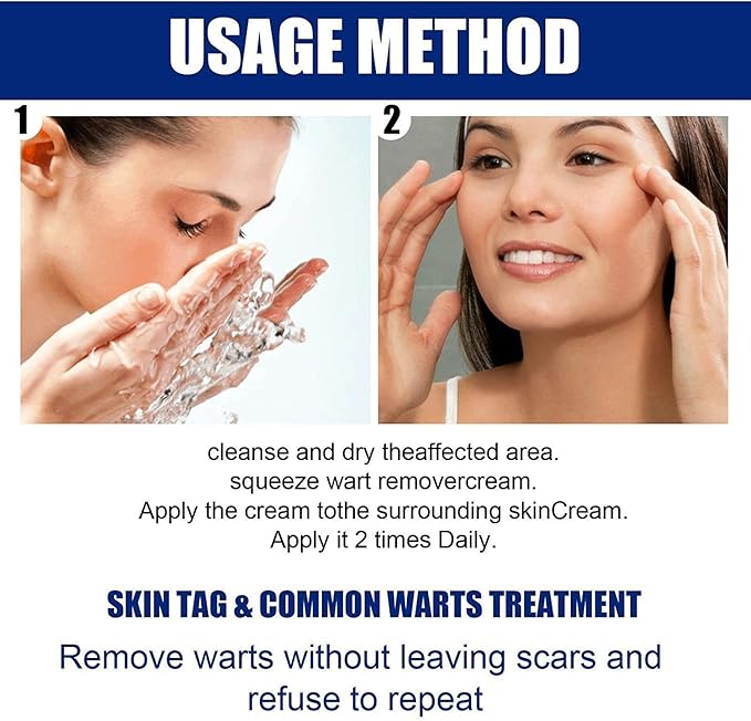 Wart Remover Instant Blemish Removal Cream 🛒✨